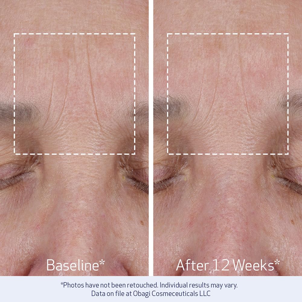 Obagi ELASTIderm Lift Up & Sculpt Facial Moisturizer – Clinically Proven Anti-Aging Face Cream that Visibly Firms & Sculpts Facial Contours, & Reduces Fine Lines & Wrinkles with Peptides – 1.7 oz