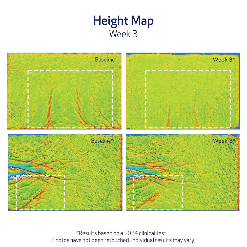Obagi ELASTIderm Lift Up & Sculpt Facial Moisturizer – Clinically Proven Anti-Aging Face Cream that Visibly Firms & Sculpts Facial Contours, & Reduces Fine Lines & Wrinkles with Peptides – 1.7 oz