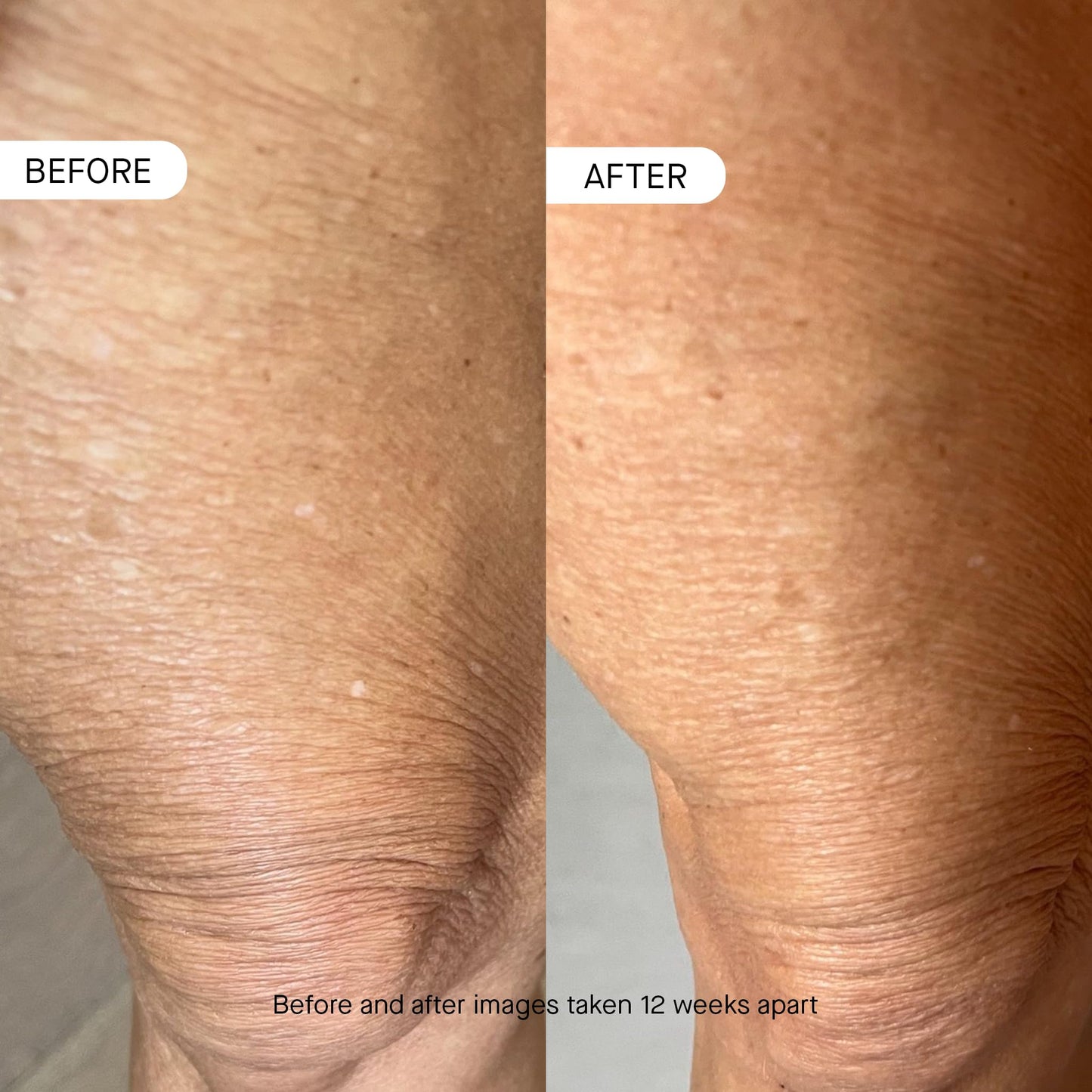 OneSkin BODY OS-01 Peptide Topical Supplement & Skin Longevity Age Reversal Moisturizer | Safe for Sensitive Skin, Fragrance-Free