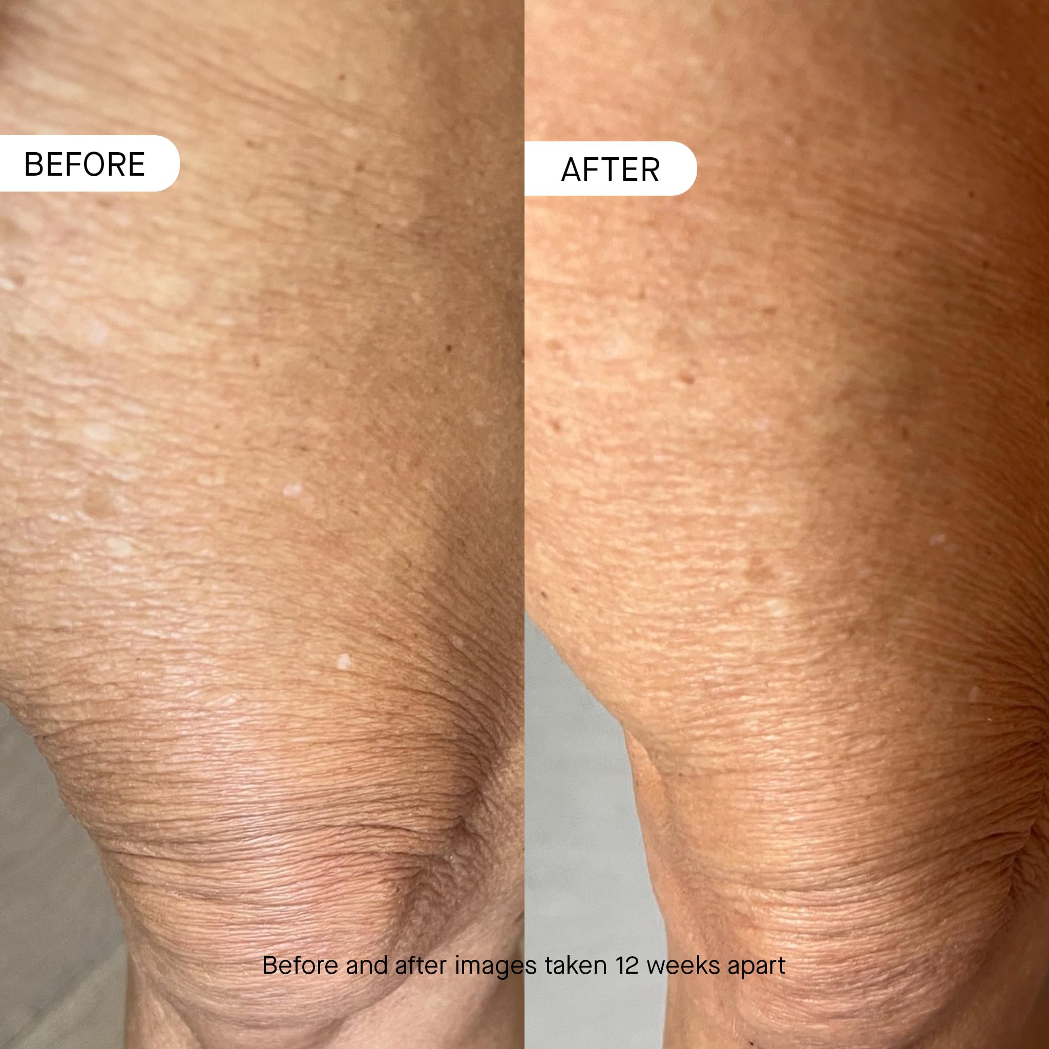 OneSkin BODY OS-01 Peptide Topical Supplement & Skin Longevity Age Reversal Moisturizer | Safe for Sensitive Skin, Fragrance-Free